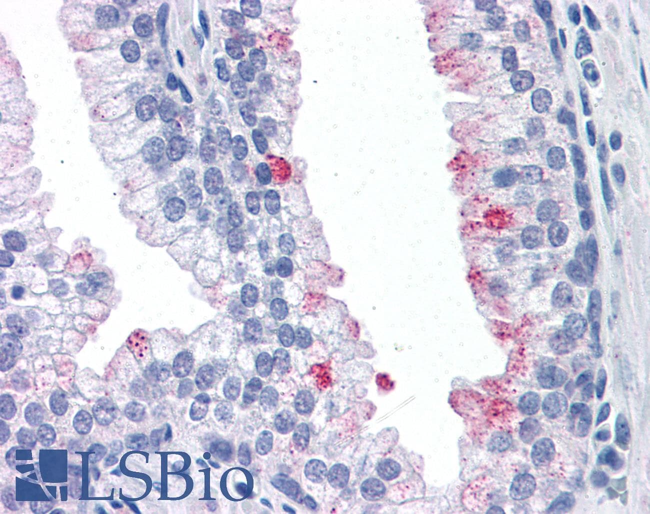 IHC-plus™ RTKN / Rhotekin Antibody (clone 2E5)