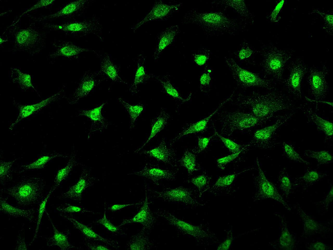 MYCL / L-Myc Antibody
