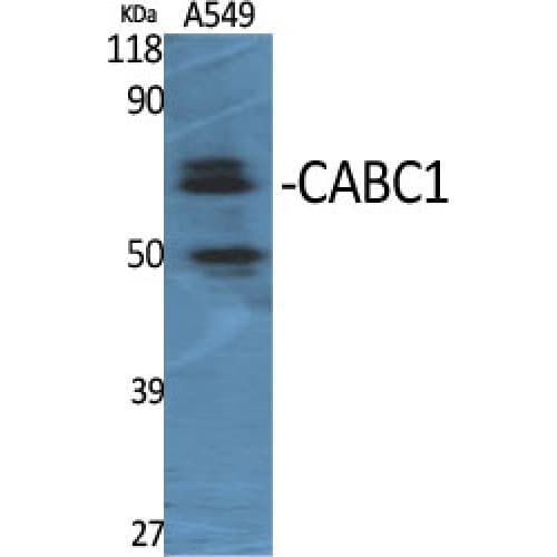 Polyclonal Rabbit anti-Human ADCK3 / CABC1 Antibody (270-350 aa, Internal, IHC, IF, WB)