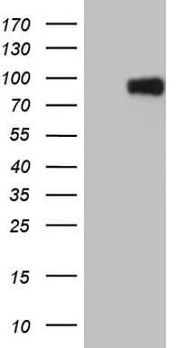 CFI / Complement Factor I Antibody (aa340-583, clone OTI17C5)