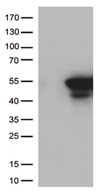 CDK15 / ALS2CR7 Antibody (aa293-378, clone OTI5C4)