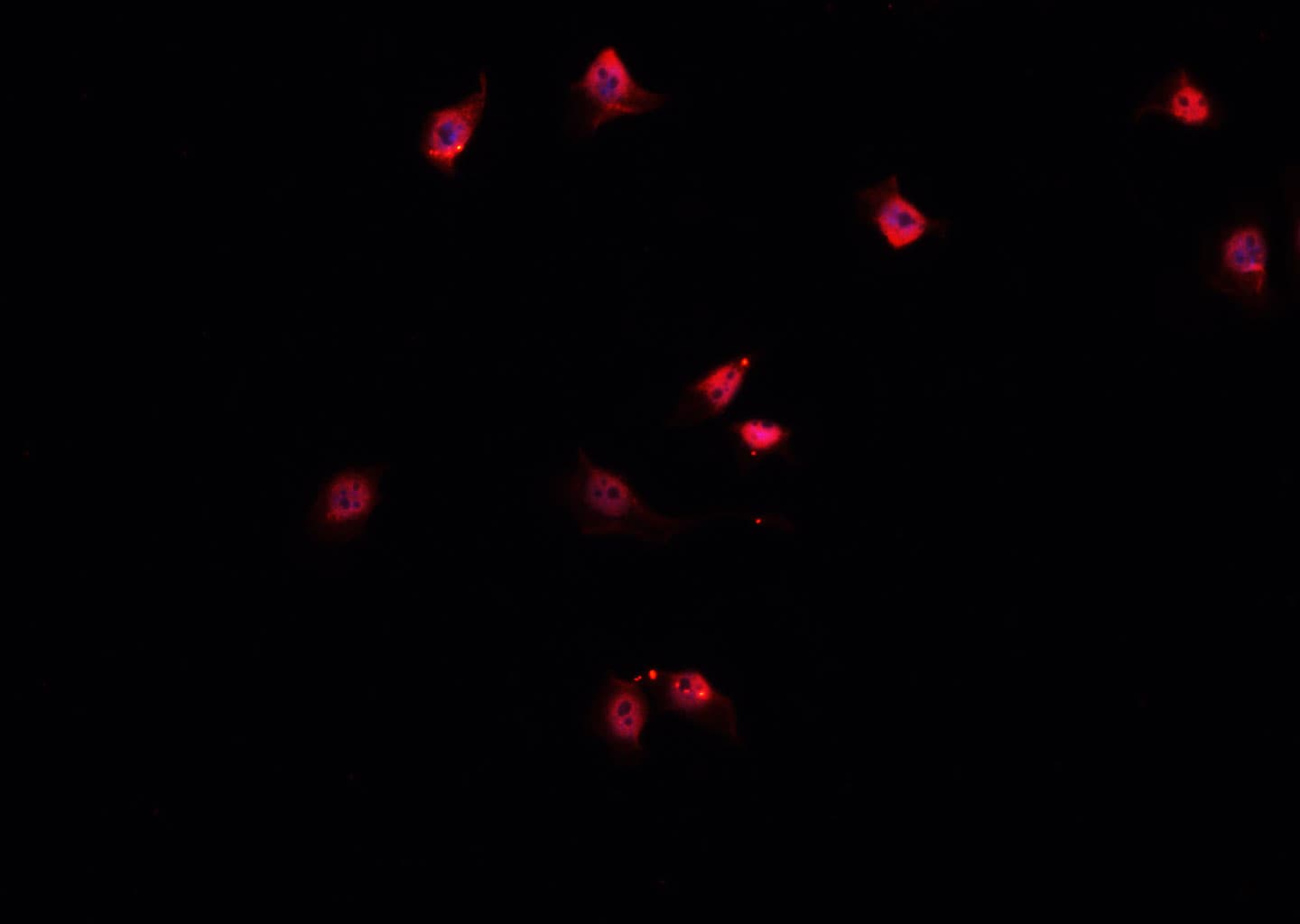 PPP1R14A / CPI-17 Antibody