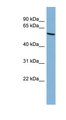 Polyclonal Rabbit anti-Human CYP2C18 / CYP2C Antibody (N-Terminus, IHC, WB)