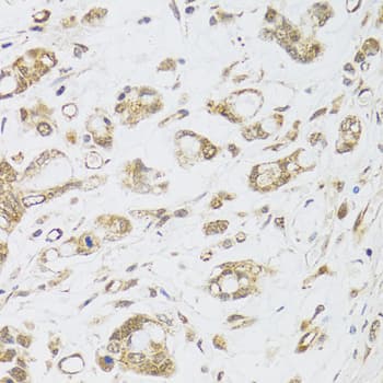 DMAP1 Antibody (AP)