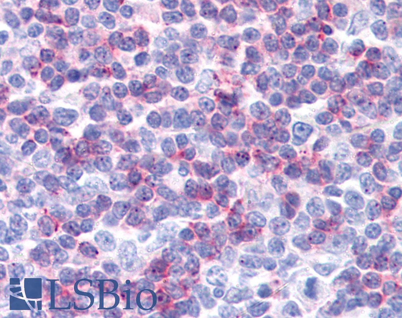 IHC-plus™ CD225 / IFITM1 Antibody