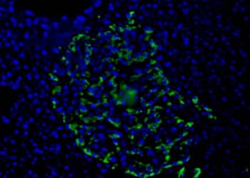 Pancreas Marker HPa1 Antibody (clone DHIC2-2C12)