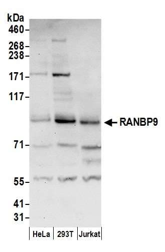 RANBPM Antibody (aa125-175)