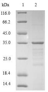 Human HMGN4 Protein (Recombinant GST, N-terminus)