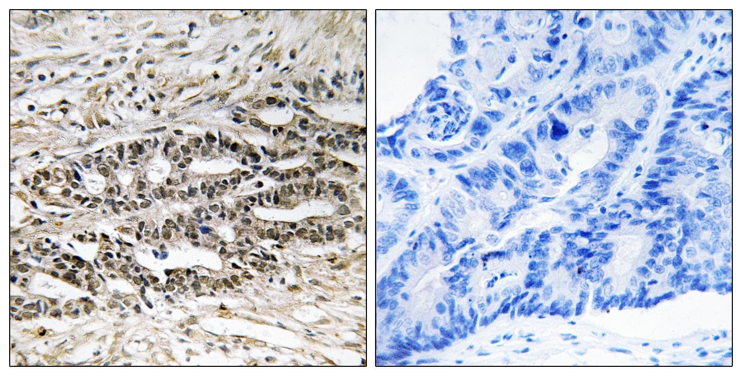 MDM4 / MDMX Antibody (aa336-385)