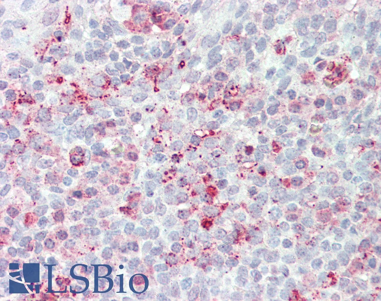 IHC-plus™ STEAP2 Antibody (Internal)