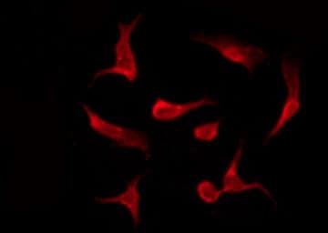Polyclonal Rabbit anti-Human EWSR1 / EWS Antibody (IF, WB)