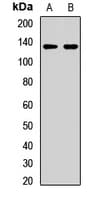 Polyclonal Rabbit anti-Human SAFB2 Antibody (IHC, WB)