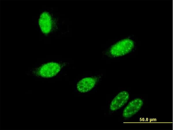 GBX2 Antibody (clone 2A4)