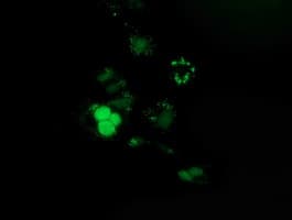PUS7 Antibody (clone OTI5F12)