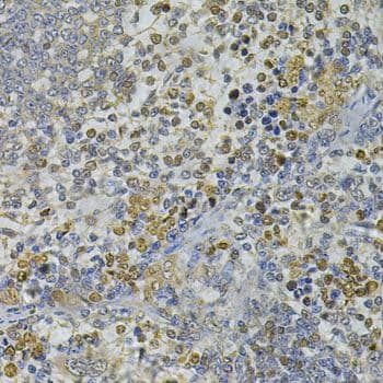 C/EBP Epsilon / CEBPE Antibody