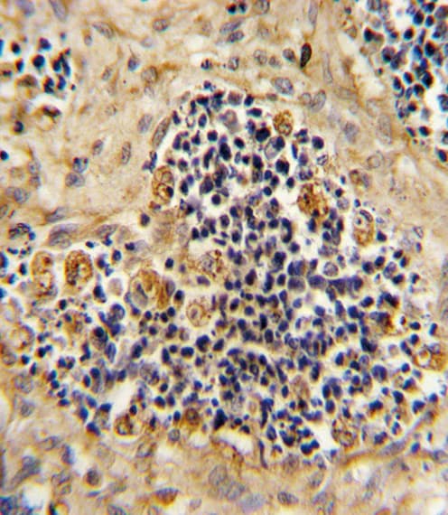 ROR2 Antibody (aa19-50)