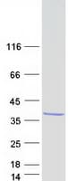 Human RFXANK Protein (Recombinant Myc-DDK (Flag))