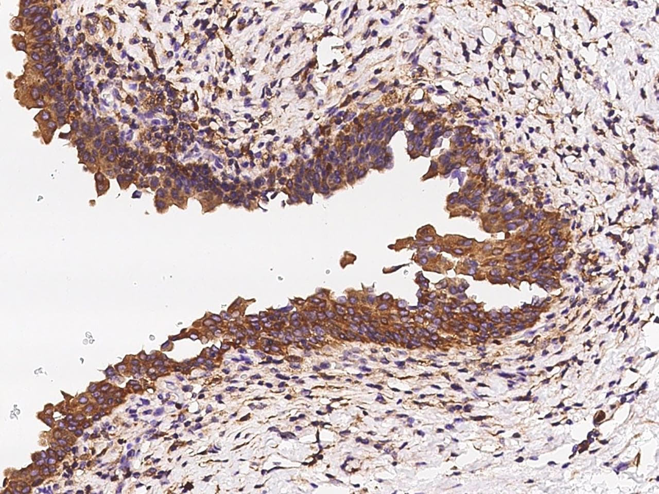 LAPTM4A Antibody