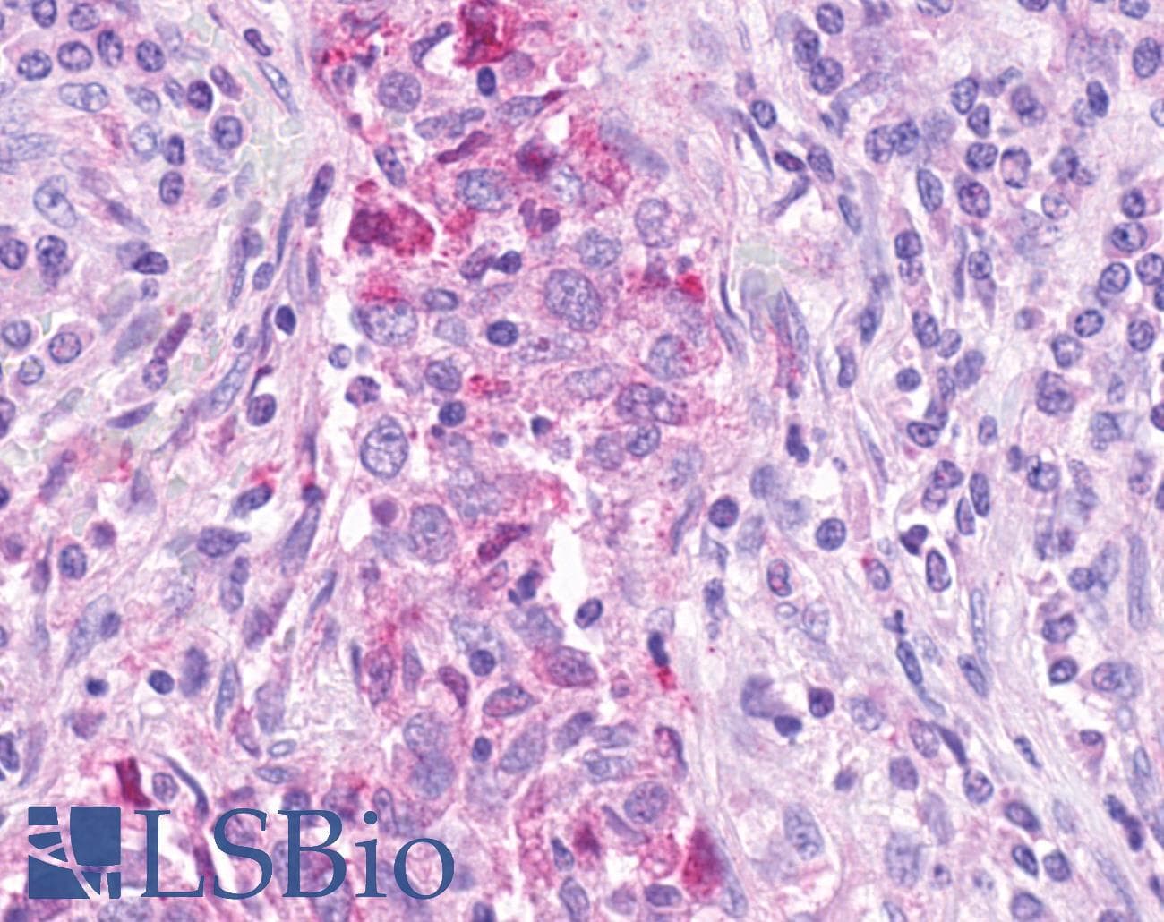 PathPlus™ LPAR2 / EDG4 Antibody (Cytoplasmic Domain)