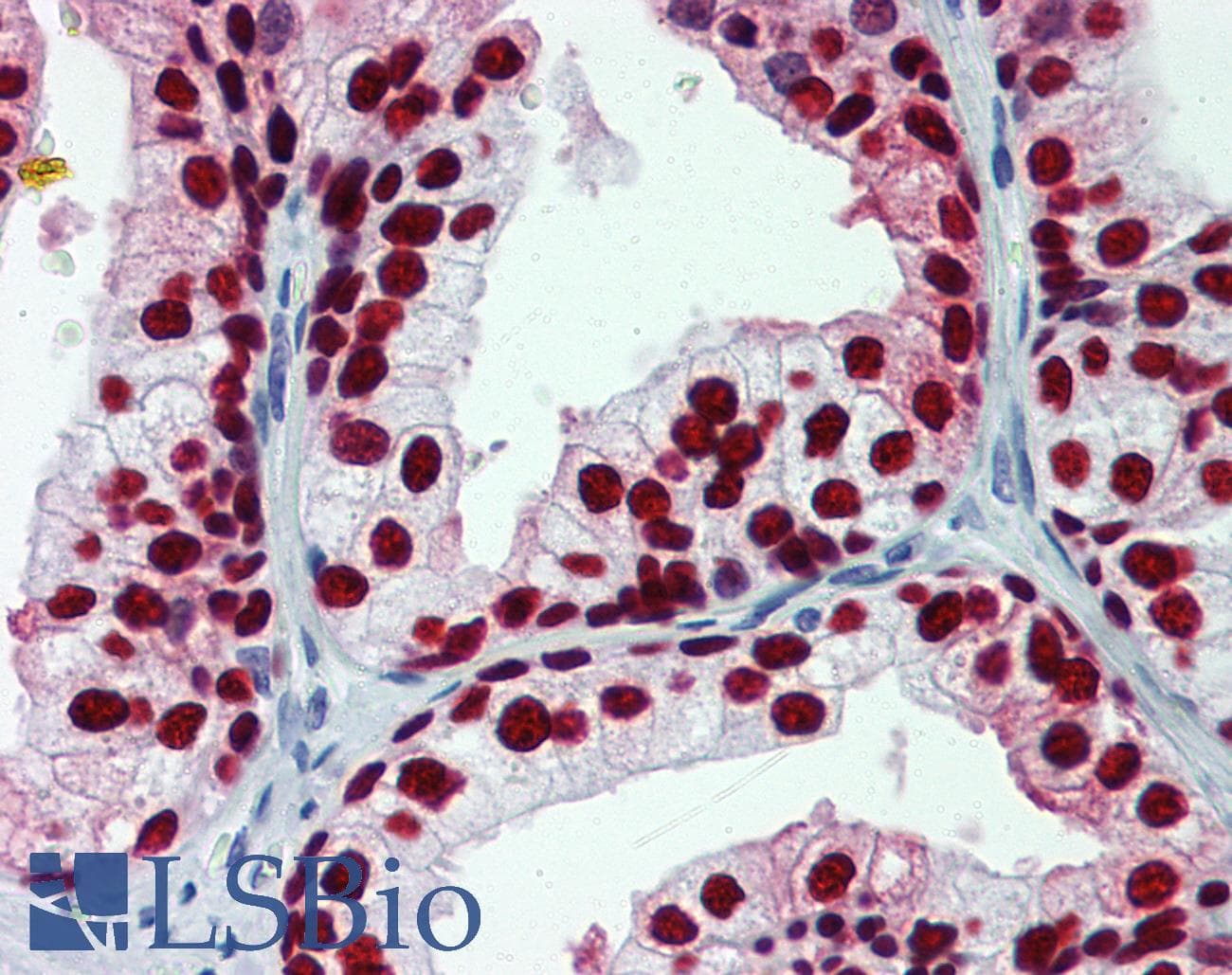 PathPlus™ FOXA1 Antibody (clone 2D7)