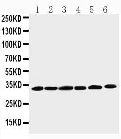 CCND1 / Cyclin D1 Antibody (N-Terminus)