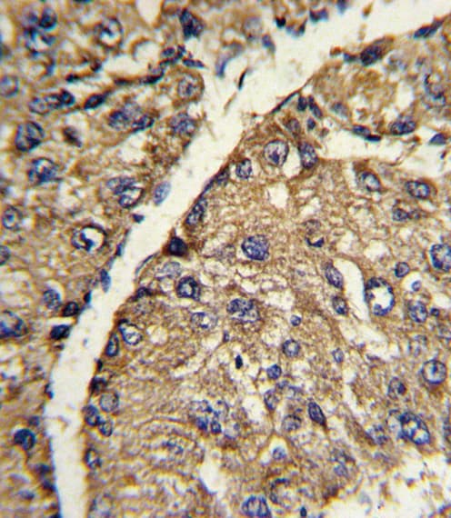 VTN / Vitronectin Antibody (aa352-379)