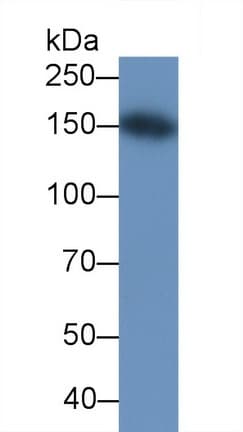 KDR / VEGFR2 / FLK1 Antibody