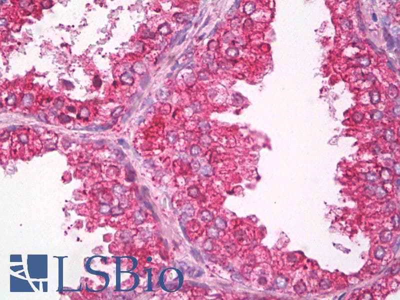 IHC-plus™ Polyclonal Rabbit anti-Human CANX / Calnexin Antibody (C-Terminus, IHC, IF, WB)