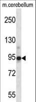 Chordin Antibody (aa439-467)