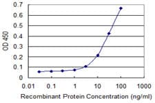 IHC-plus™ PYGM Antibody (clone 2C4)