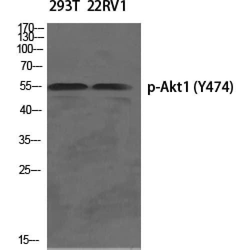 AKT1 Antibody (410-490 aa)