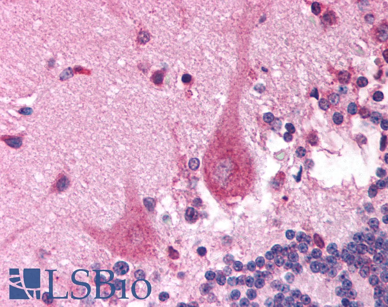 PITX3 Antibody (N-Terminus, HRP)