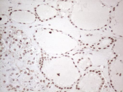 NR2C2 / TAK1 Antibody (aa1-241, clone OTI4B1)