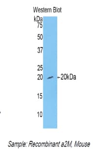 A2M / Alpha-2-Macroglobulin Antibody (aa1053-1214)