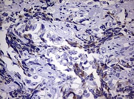 EGFR Antibody (aa900-1210, clone OTI3F2, Carrier-free)