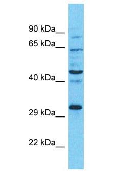 RAD51 / RECA Antibody (aa231-280)