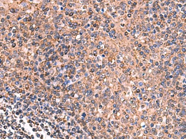 GALK2 Antibody