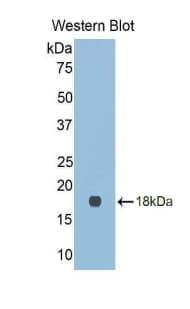 LGALS9C Antibody (aa17-148)