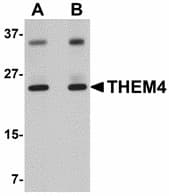 IHC-plus™ CTMP / THEM4 Antibody