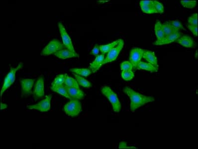 FOLR1 / Folate Receptor Alpha Antibody
