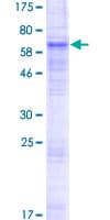 Human SLC10A6 Protein (Recombinant GST)