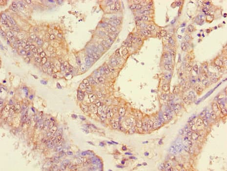 CHFR Antibody