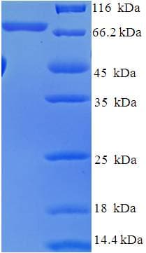 Human AKT2 Protein (Recombinant His-SUMO)