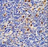 LTA4H / LTA4 Antibody (aa163-191)