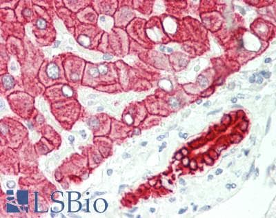 CRAT Antibody (aa22-71)