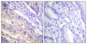 PTEN Antibody (phospho-Ser385)