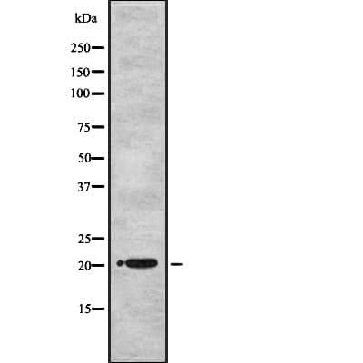 UBE2M / UBC12 Antibody