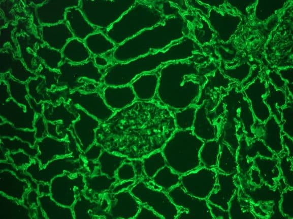 PathPlus™ Collagen IV Antibody
