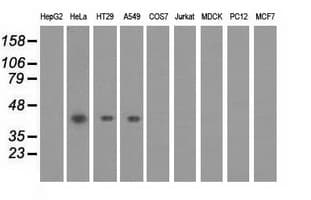 PAICS / ADE2 Antibody (clone OTI2C9)
