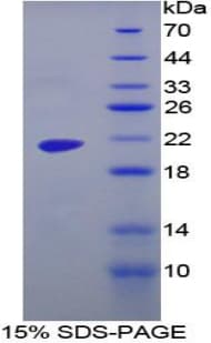 Human MGAM / Maltase-Glucoamylase Protein (Recombinant 6His, N-terminus)